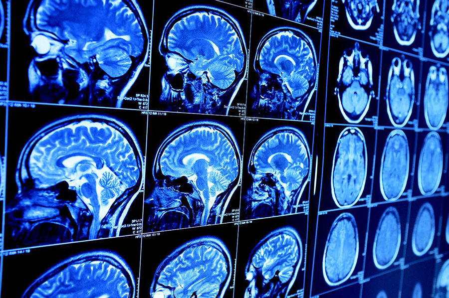 Tunisie : la téléradiologie se déploie à l’échelle nationale
