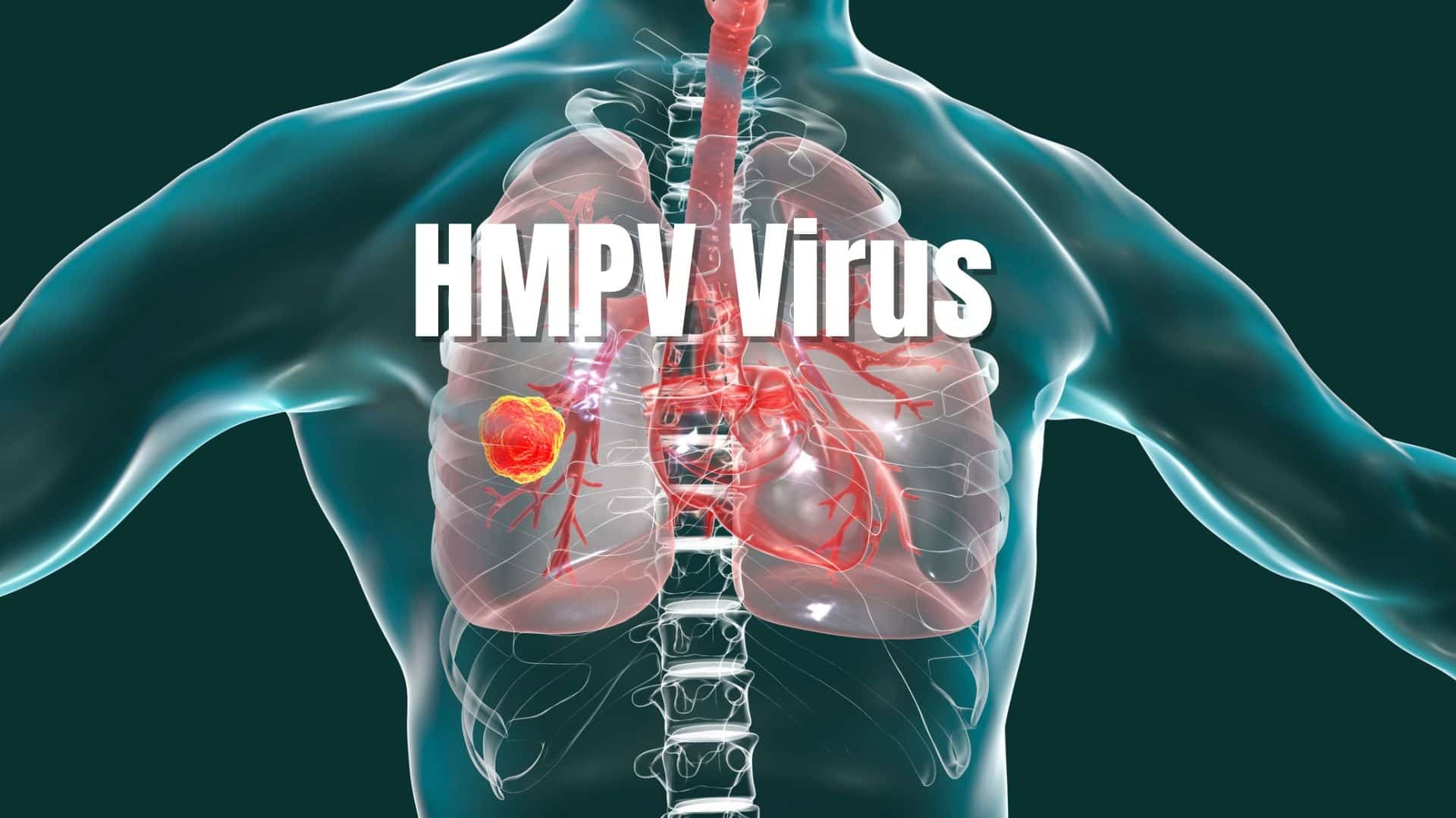 Un nouveau virus inquiète, mais ressemble-t-il à la COVID-19 ?